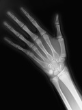 X-ray of a Hand Lámina fotográfica por Maxine Hall