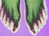 X-ray of Feet Photographie