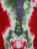 X-ray of a Torso Photographie