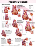 Heart Disease Anatomical Chart 2nd Edition Poster Print Posters