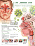 Understanding the Common Cold Anatomical Chart 2nd Edition Poster Print Pôsteres Understanding the Common Cold Anatomical Chart 2nd Edition Poster Print Pôsteres