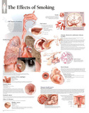 Effects of Smoking Educational Chart Poster Photo