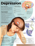 Understanding Depression Anatomical Chart 2nd Edition Poster Print Posters