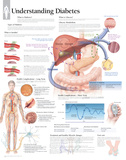 Understanding Diabetes Educational Chart Poster Poster