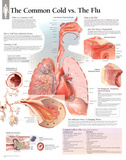 The Common Cold vs Flu Educational Chart Poster Photo