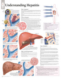 Understanding Hepatitis Educational Chart Poster Posters
