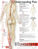 Understanding Pain Anatomical Chart Poster Print Posters
