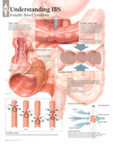 Understanding IBS Educational Disease Chart Poster Prints