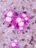 Low-Density Lipoprotein, LDL, and High-Density Lipoprotein, HDL, TEM X297,000 Photographic Print by Hans Ackermann