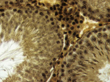 Interstitial Cell or Leydig Cell of the Testis Between Seminiferous Tubules Photographic Print by Robert Calentine