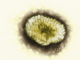 The Brick-Shaped Parapoxvirus Affects Numerous Wild and Domestic Animals Photographic Print by Hans Ackermann