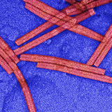 Negatively-Stained (Uranyl Acetate) Tobacco Mosaic Virus (TMV), TEM Photographic Print by Timothy Baker