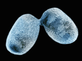 Mycobacterium Genavense Bacteria Mycobacterium Genavense Can Cause Disseminiated Infections Photographic Print by Hans Ackermann