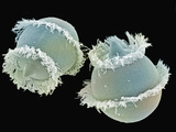 Didinium Is a Predatory Protozoan, it Eats Other Protozoans, That Feeds Primarily on Paramecium Photographic Print by Aaron Bell