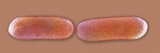 (Listeria Monocytogenes) Bacteria, EM X36,300 Photographic Print by Hans Ackermann