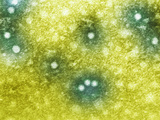Parvoviruses Cause Fifth Disease in Humans, Mostly in Children But Sometimes in Adults Photographic Print by Hans Ackermann
