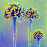 Conidia of Aspergillus Flavens, SEM X650 Photographic Print by Merton Brown