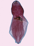Fluke (Alaria), a Parasitic Flatworm, LM X6 Photographic Print by Robert Calentine