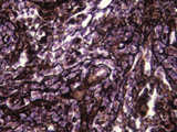 Reticular Fibers in a Lymph Node, LM X450 Photographic Print by Robert Calentine