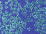 The Bovine Papillomavirus Causes Large, Wart-Like Structures in Cattle Photographic Print by Timothy Baker