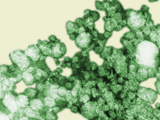Normal Low Density Lipoproteins (LDL) Which May Be Used to Diagnose Human Conditions Photographic Print by Hans Ackermann
