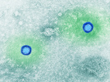 The Norwalk Agent Virus Causes Gastrointestinal Problems Photographic Print by Hans Ackermann