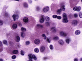 Human Pars Distalis of the Pituitary Gland, LM X450 Photographic Print by Robert Calentine
