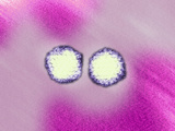 Adenovirus, TEM X297,000 Photographic Print by Hans Ackermann
