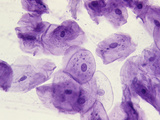 Human Stained Cheek Cells, Squamous Epithelium, LM X100 Photographic Print by Robert Calentine
