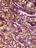 Trematode Lung Fluke Eggs in the Lung (Paragonimus), LM X100 Photographic Print by Robert Calentine
