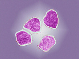 Paramyxoviruses are Group of Viruses That Include the Pathogens of Measles, Rubeola, Mumps Photographic Print by Hans Ackermann