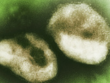 Paramyxoviruses are Group of Viruses That Include the Pathogens of Measles, Rubeola, Mumps Photographic Print by Hans Ackermann