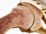 Longitudinal Section of the Humerus the Outer Portion Is the Compact Bone and the Inner Portion Fotografie-Druck von Donald Fawcett