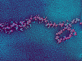 Ribosomes from the Salivary Gland of an Insect Fotografie-Druck von Donald Fawcett