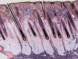 Cross-Section of the Skin on the Human Scalp Fotografie-Druck von Donald Fawcett