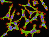 Helcells: Immortal Cultured Human Cancer (Hela) Photographic Print by Thomas Deerinck