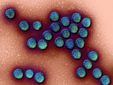 The Rotavirus Is the Most Common Cause of Severe Diarrhea Among Children Photographic Print by Hans Gelderblom