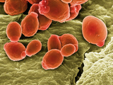 Yeast (Candida Albicans) on Epithelial Cells of Finger Photographic Print by Stanley Flegler