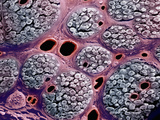 Cross-Section of a Nerve Showing Nerve Fibers Organized into Bundles or Fascicles Photographic Print by Richard Kessel