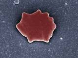 Human Red Blood Cell (Erythrocyte) after 1/2 Minute in a Severely Hypotonic Solution (0% Nacl) Photographic Print by Stanley Flegler