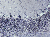 Central Nervous System, Purkinje Cells in Cerebellum, LM X80 Photographic Print by Ralph Hutchings