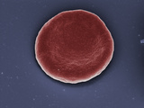 Human Red Blood Cell (Erythrocyte) in Isotonic Solution (0.9% Nacl), SEM X10,000 (Based on 4" X 5") Photographic Print by Stanley Flegler