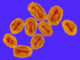 Variola Major, One of the Two Types of the Smallpox Virus Photographic Print by Hans Gelderblom