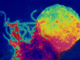 Measles, also Called Rubeola, Is Best known for its Typical Skin Rash Photographic Print by Hans Gelderblom