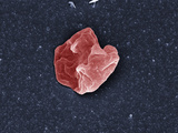 Human Red Blood Cell (Erythrocyte) after 1 Minute in a Severely Hypotonic Solution (0% Nacl), Photographic Print by Stanley Flegler