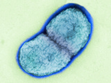 Actinobacillus Actinomycetemcomitans Undergoing Cell Division, Gram-Negative Coccobacillus Photographic Print by Scott Kachlany