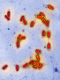 The Vesicular Stomatitis Virus Is an Important Pathogenic Virus of Cattle Photographic Print by Gopal Murti