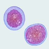 Pneumocystis Section, a Yeast-Like Fungus Pathogen, TEM X15,000 Photographic Print by Gopal Murti