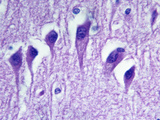 Human Brain Outer Choroid Plexus Cells, LM X200 Photographic Print by Arthur Siegelman