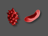 Crenated and Normal Red Blood Cells, SEM X6000 Photographic Print by Gopal Murti